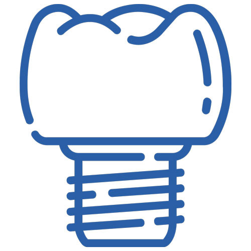 dental implants