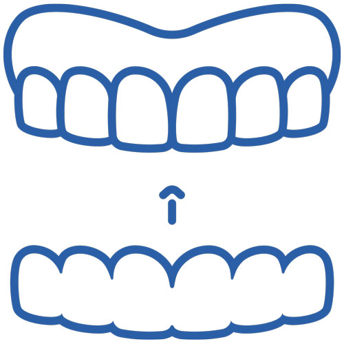 invisalign treatment