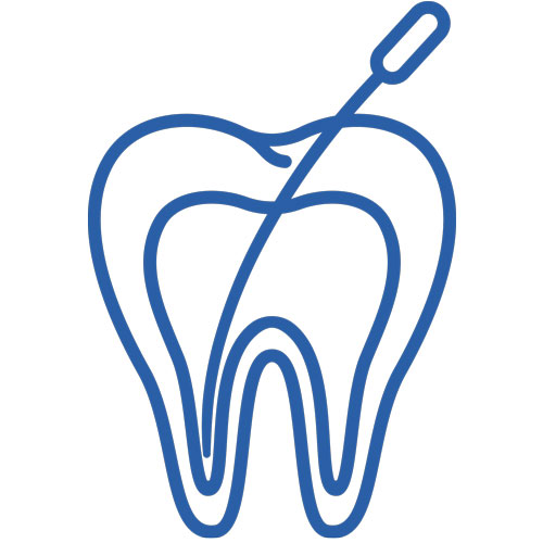 root canals